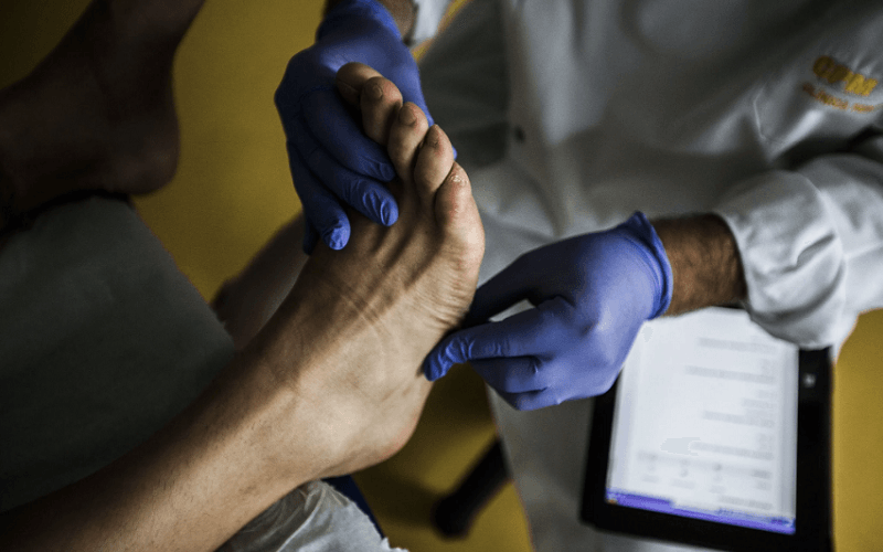 Estudo aponta relação entre Covid-19 e frieiras nos pés