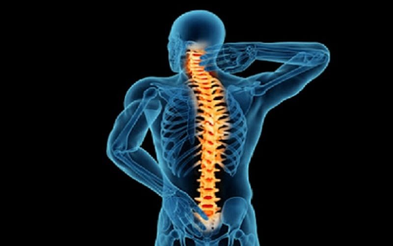 Entidade de Brasília lança aplicativo para identificar doença nas costas