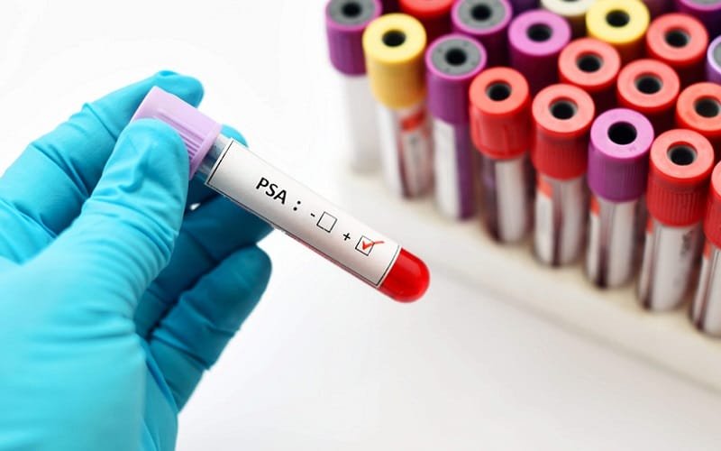 Contratação de serviços médicos complementares de radioterapia