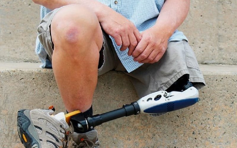 Campanha chama a atenção para meio milhão de amputados