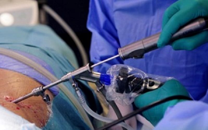 cirurgia endoscópica biportal por via anterior Misto Brasília