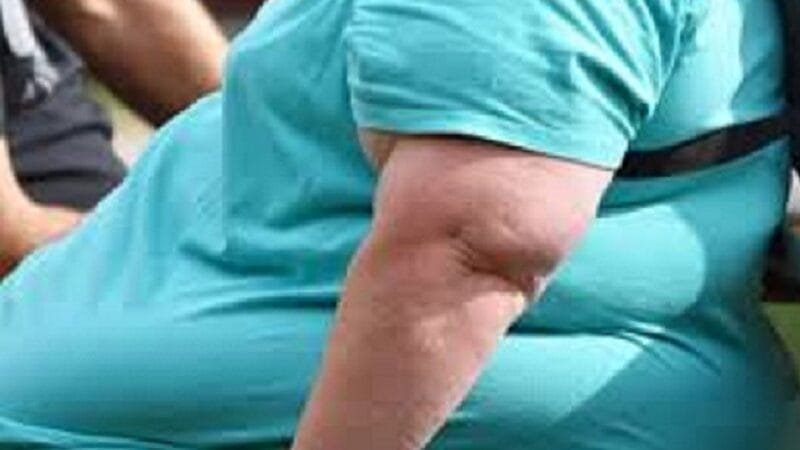 Distritais irão discutir o Estatuto da Pessoa com Obesidade