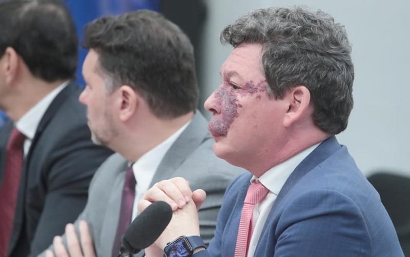 Deputado Reginaldo Lopes reforma tributária Misto Brasil