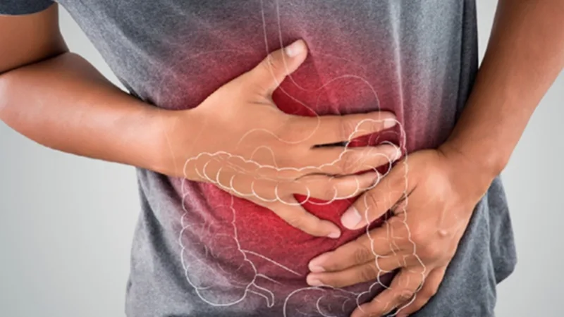 Câncer de intestino é o terceiro tio mais frequente no DF