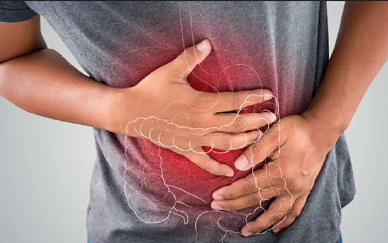 Câncer de intestino é o terceiro tio mais frequente no DF